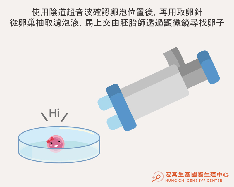 取卵步驟 - 宏生_4